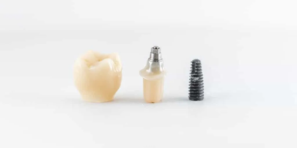 dental implants in Markham