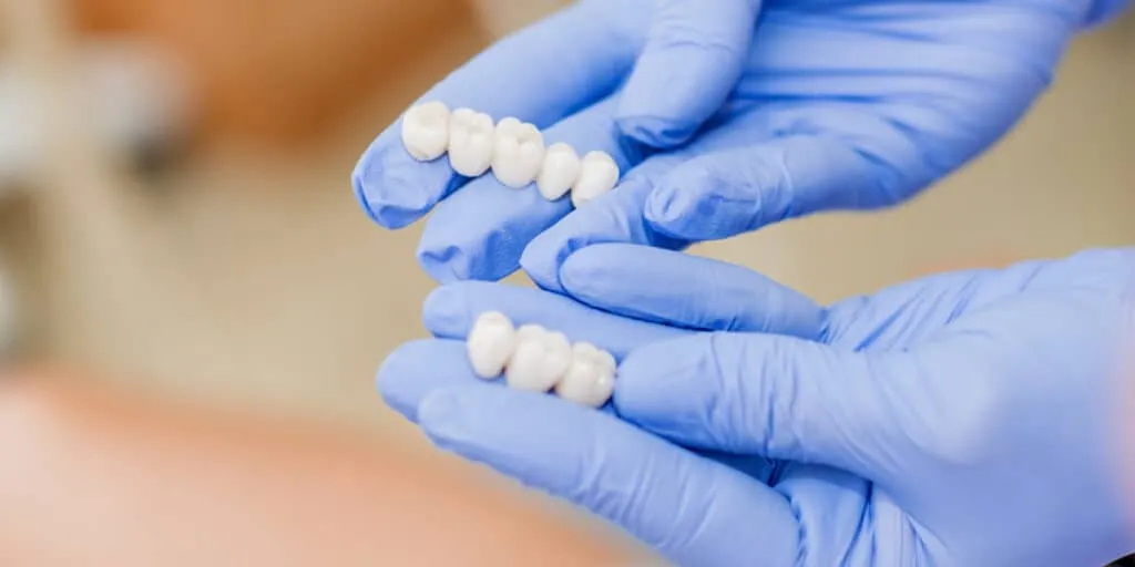 Dental bridges restorative procedure in Markham office