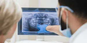 X-ray result from root canal therapy in Markham