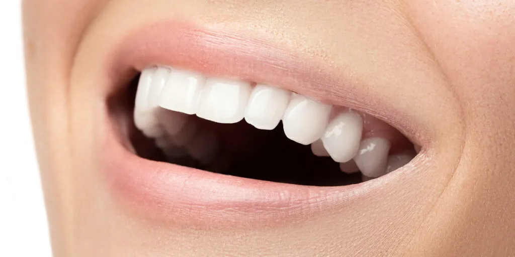 Teeth whitening in Markham