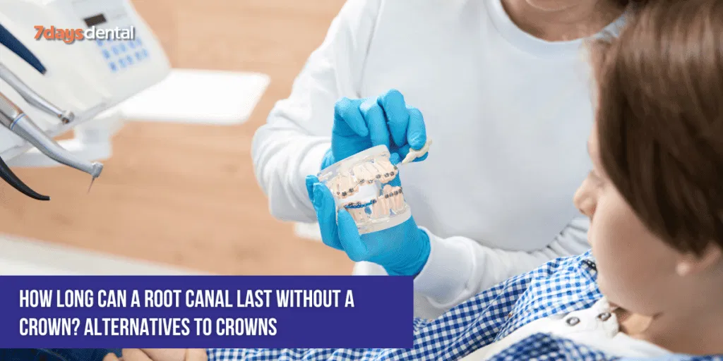 How Long Can a Root Canal Last Without a Crown? Alternatives to Crowns
