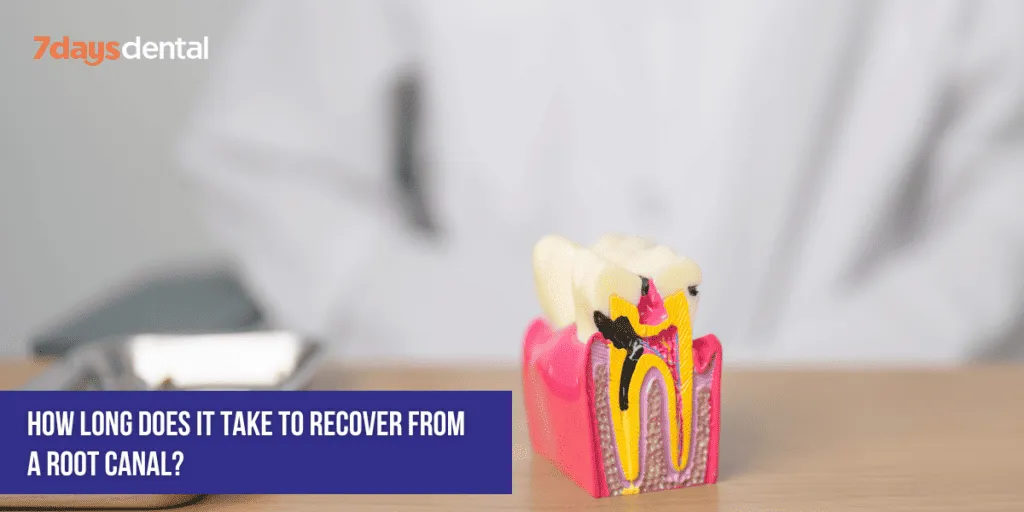 How Long Does it Take to Recover from a Root Canal?