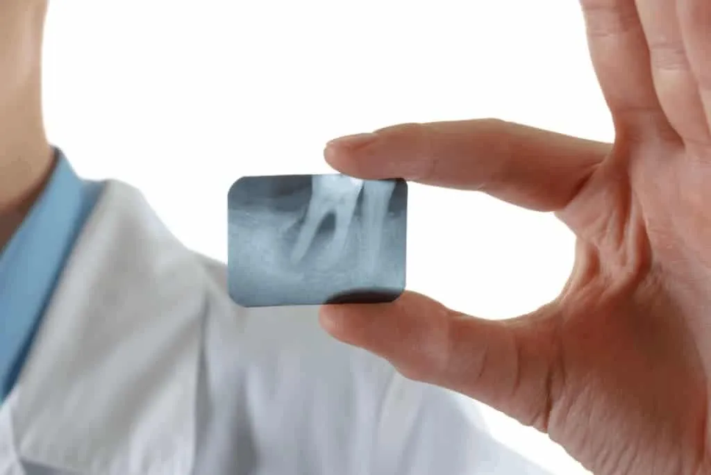 Periodontal Therapy in Markham