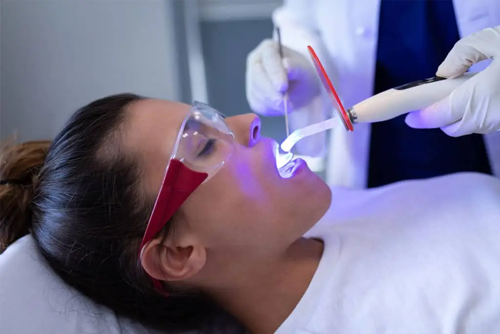 dental sealants - Markham dentists by 7 Days Dental