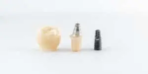 dental implants in Markham