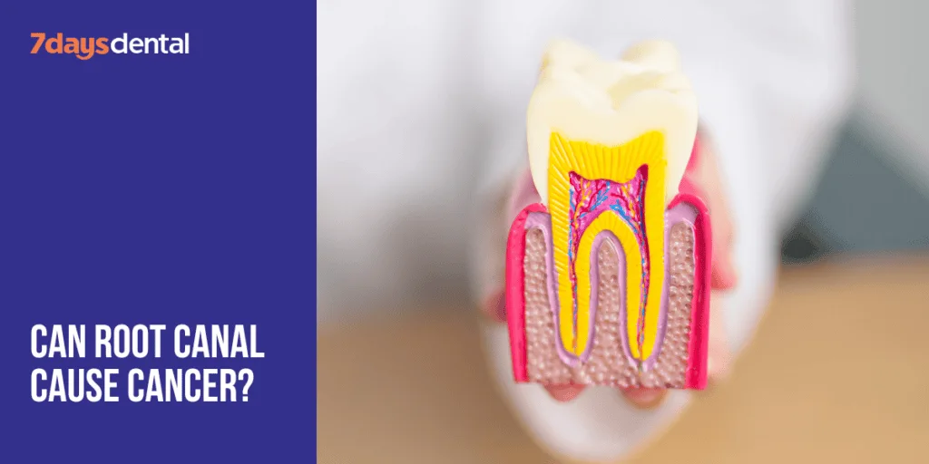 Can Root Canal Cause Cancer?