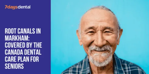 Root Canals in Markham: Covered by the Canada Dental Care Plan for Seniors